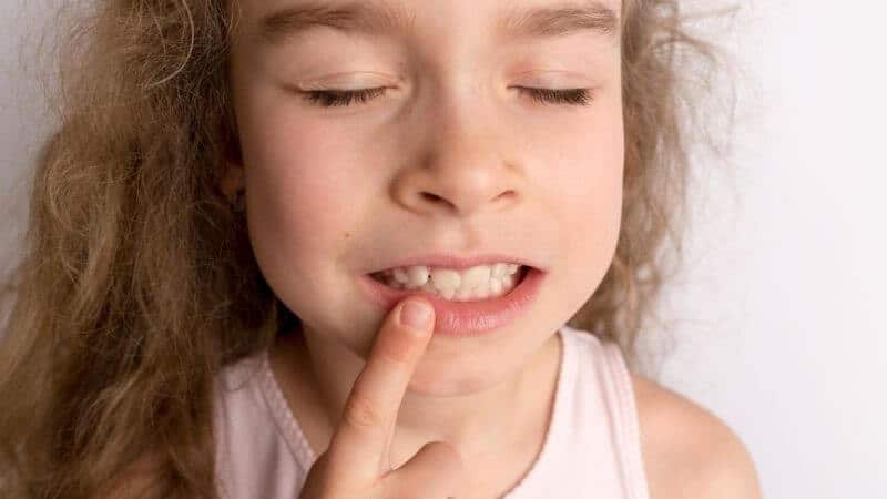 【海外在住体験記】子どもの歯列矯正の必要性と現実〜スイス編。曲がった前歯を指差す少女